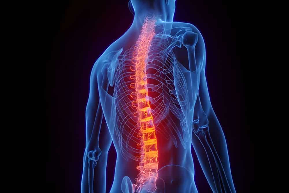 ¿Qué es la artrosis vertebral? Síntomas y tratamiento